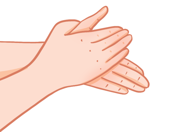 免洗洗手液的好處和壞處，使用時要注意什么，用了粘手咋回事